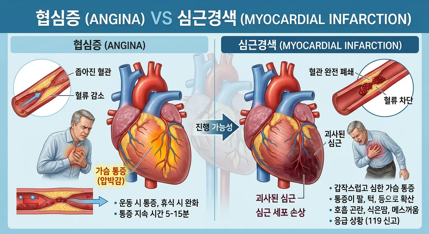 협심증 심근경색